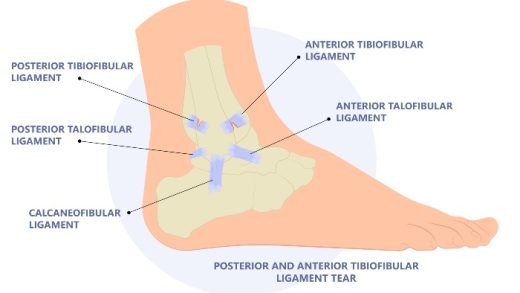 Tracking NHL injuries for the 2024-25 season: Mat Brazal and Connor McDavid among players sidelined, including a significant ankle injury